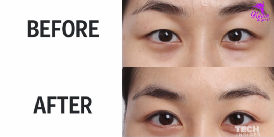 Kore Güzellik Çift göz kapağı
